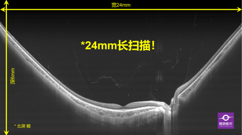 广东省胆结石专科广东省胆结石专科，专业治疗胆结石的前沿技术与卓越服务