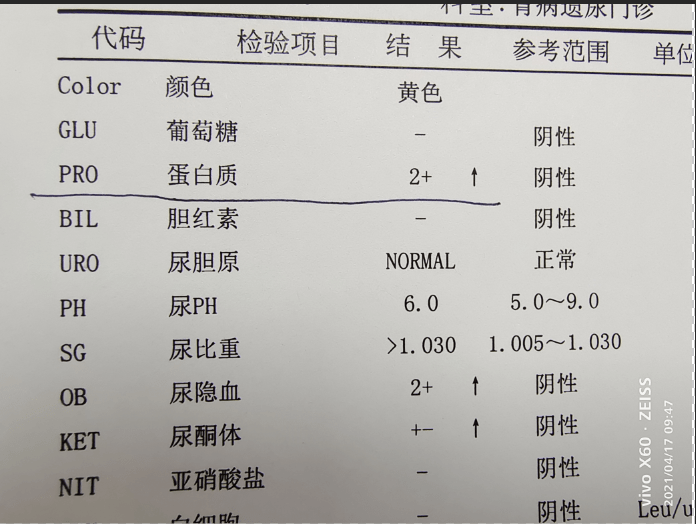 四个月宝宝尿多少次四个月宝宝尿尿次数解析